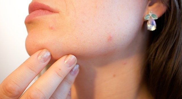 10 Monsoon Skincare Tips To Get Glowing Skin
